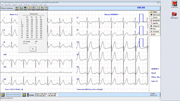 Nasiff CardioResting Screenshot